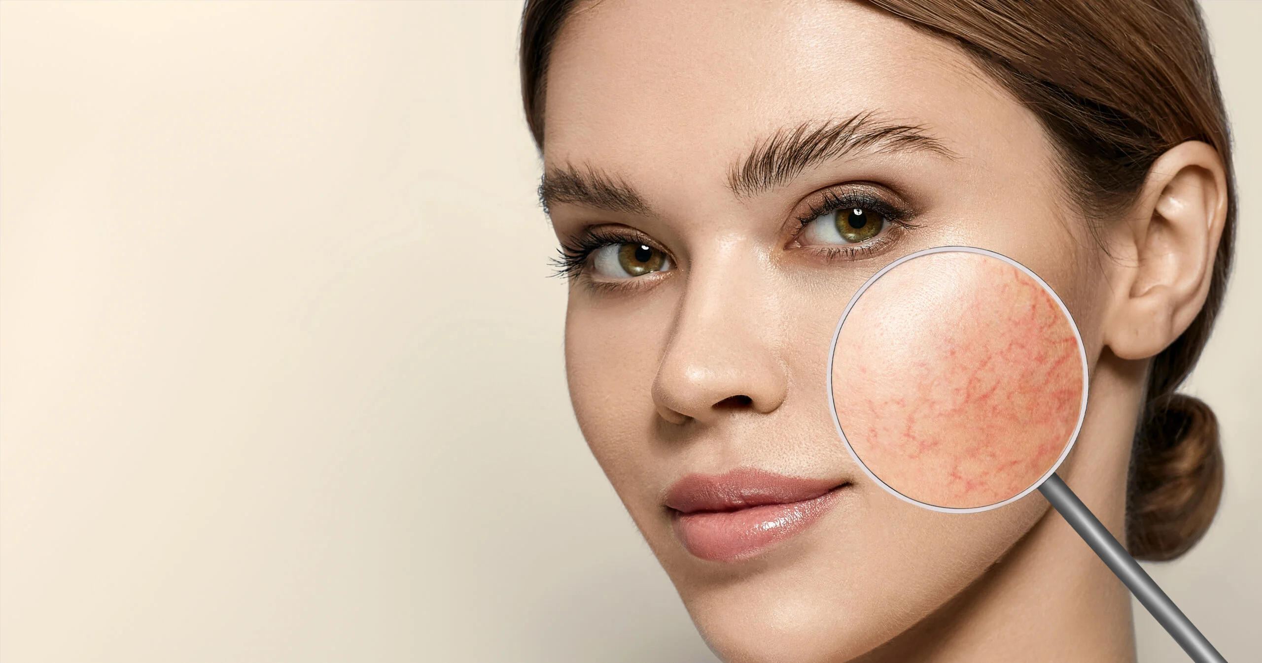 Sensitive skin